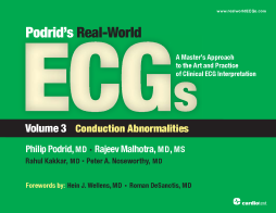 Podrid's Real-World ECGs: Volume 3, Conduction Abnormalities Podrid's Real-World ECGs: Volume 3, Conduction Abnormalities