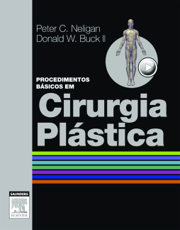 Procedimentos Básicos em Cirurgia Plástica Procedimentos Básicos em Cirurgia Plástica