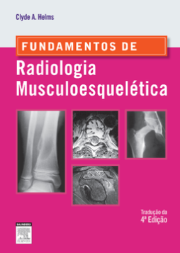 Fundamentos de Radiologia Musculoesquelética
