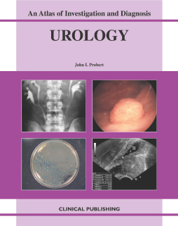 Urology: an Atlas of Investigation and Management Urology: an Atlas of Investigation and Management
