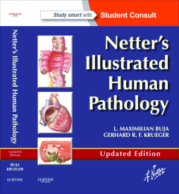 Netter's Illustrated Human Pathology Updated Edition E-book Netter's Illustrated Human Pathology Updated Edition E-book