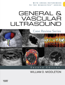 General and Vascular Ultrasound E-Book General and Vascular Ultrasound E-Book