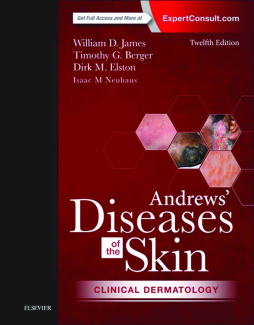 Andrews' Diseases of the Skin E-Book Andrews' Diseases of the Skin E-Book