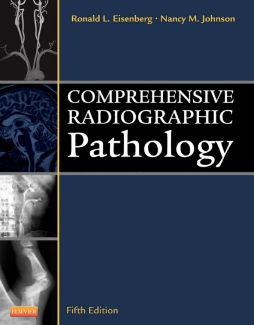 Comprehensive Radiographic Pathology - E-Book Comprehensive Radiographic Pathology - E-Book
