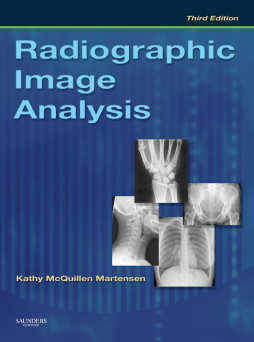 Radiographic Image Analysis - E-Book Radiographic Image Analysis - E-Book