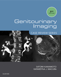 Genitourinary Imaging: Case Review Series E-Book Genitourinary Imaging: Case Review Series E-Book