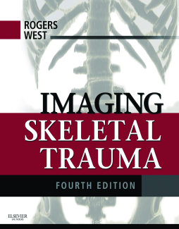 Imaging Skeletal Trauma E-Book Imaging Skeletal Trauma E-Book