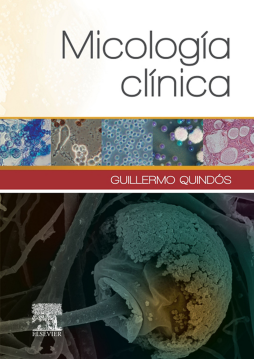 Micología clínica Micología clínica