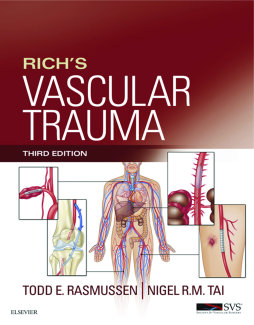 Rich’s Vascular Trauma E-Book Rich’s Vascular Trauma E-Book