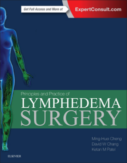 Principles and Practice of Lymphedema Surgery E-Book Principles and Practice of Lymphedema Surgery E-Book