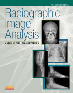 Radiographic Image Analysis - E-Book Radiographic Image Analysis - E-Book