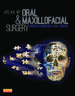 Atlas of Oral and Maxillofacial Surgery- E-Book Atlas of Oral and Maxillofacial Surgery- E-Book