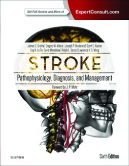 Stroke E-Book Stroke E-Book