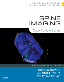 Spine Imaging E-Book
