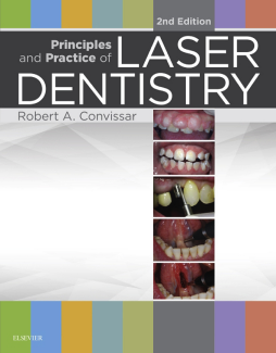 Principles and Practice of Laser Dentistry - E-Book Principles and Practice of Laser Dentistry - E-Book