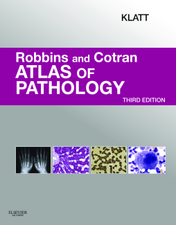 Robbins and Cotran Atlas of Pathology E-Book