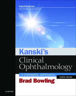 Kanski's Clinical Ophthalmology E-Book