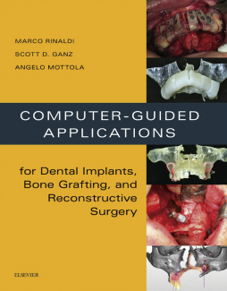 Computer-Guided Dental Implants and Reconstructive Surgery - E-Book Computer-Guided Dental Implants and Reconstructive Surgery - E-Book