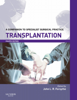 Transplantation Transplantation