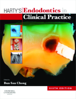 Harty's Endodontics in Clinical Practice E-Book