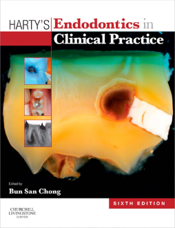 Harty's Endodontics in Clinical Practice E-Book Harty's Endodontics in Clinical Practice E-Book