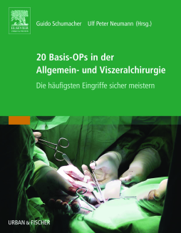 20 Basis-OPs in der Allgemein- und Viszeralchirurgie 20 Basis-OPs in der Allgemein- und Viszeralchirurgie
