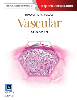 Diagnostic Pathology: Vascular E-Book Diagnostic Pathology: Vascular E-Book