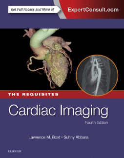 Cardiac Imaging: The Requisites E-Book Cardiac Imaging: The Requisites E-Book