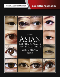 Asian Blepharoplasty and the Eyelid Crease E-Book Asian Blepharoplasty and the Eyelid Crease E-Book