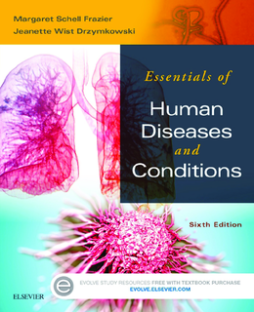 Essentials of Human Diseases and Conditions - E-Book Essentials of Human Diseases and Conditions - E-Book