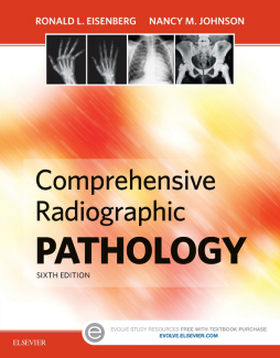 Comprehensive Radiographic Pathology - E-Book Comprehensive Radiographic Pathology - E-Book