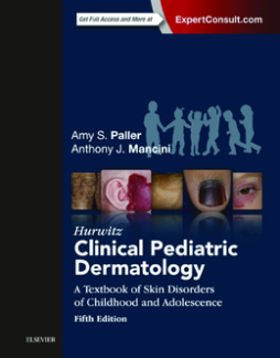 Hurwitz Clinical Pediatric Dermatology E-Book Hurwitz Clinical Pediatric Dermatology E-Book