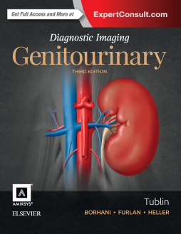 Diagnostic Imaging: Genitourinary E-Book Diagnostic Imaging: Genitourinary E-Book