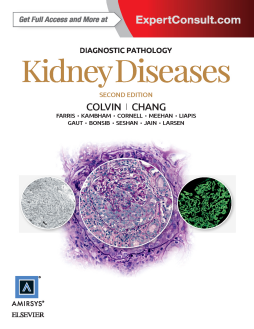 Diagnostic Pathology: Kidney Diseases E-Book Diagnostic Pathology: Kidney Diseases E-Book