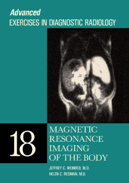 Magnetic Resonance Imaging of the Body Magnetic Resonance Imaging of the Body