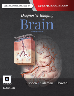 Diagnostic Imaging: Brain E-Book Diagnostic Imaging: Brain E-Book