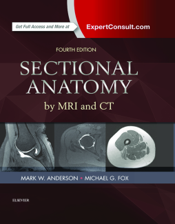 Sectional Anatomy by MRI and CT E-Book Sectional Anatomy by MRI and CT E-Book