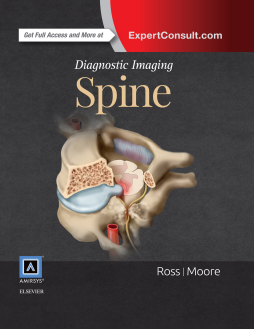 Diagnostic Imaging: Spine E-Book Diagnostic Imaging: Spine E-Book