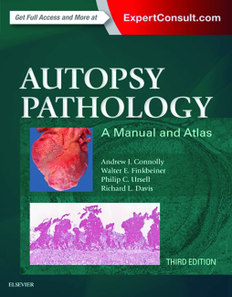 Autopsy Pathology: A Manual and Atlas E-Book Autopsy Pathology: A Manual and Atlas E-Book