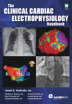 The Clinical Cardiac Electrophysiology Handbook The Clinical Cardiac Electrophysiology Handbook