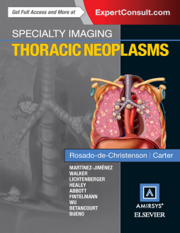 Specialty Imaging: Thoracic Neoplasms E-Book Specialty Imaging: Thoracic Neoplasms E-Book