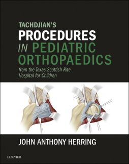 Tachdjian's Procedures in Pediatric Orthopaedics Tachdjian's Procedures in Pediatric Orthopaedics