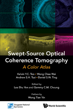 Swept-source Optical Coherence Tomography: A Color Atlas Swept-source Optical Coherence Tomography: A Color Atlas