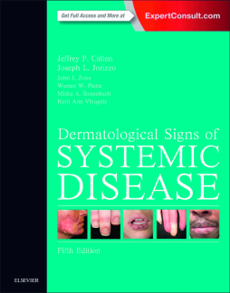 Dermatological Signs of Systemic Disease E-Book Dermatological Signs of Systemic Disease E-Book