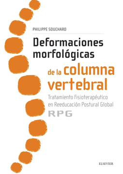 Deformaciones morfológicas de la columna vertebral Deformaciones morfológicas de la columna vertebral