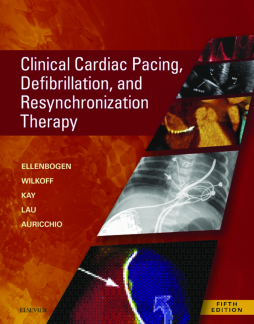 Clinical Cardiac Pacing, Defibrillation and Resynchronization Therapy E-Book Clinical Cardiac Pacing, Defibrillation and Resynchronization Therapy E-Book