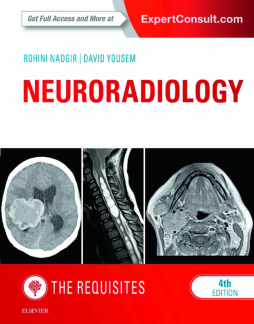 Neuroradiology: The Requisites E-Book Neuroradiology: The Requisites E-Book