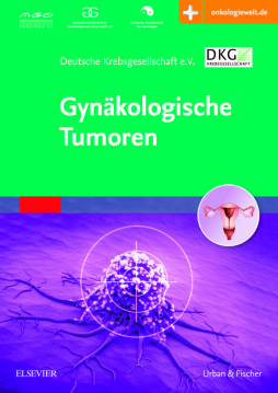 Gynäkologische Tumoren Gynäkologische Tumoren