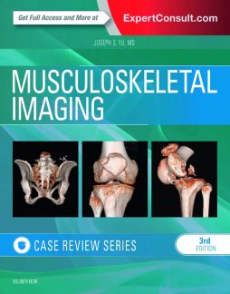 Musculoskeletal Imaging: Case Review Series E-Book Musculoskeletal Imaging: Case Review Series E-Book