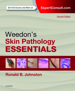 Weedon's Skin Pathology Essentials E-Book Weedon's Skin Pathology Essentials E-Book
